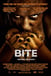 Child Bite
